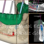 Cirugía Guiada en Clínica Dental EOS -- Dr. Bruno Ruiz Gómez